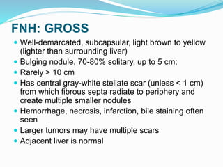 FNH: GROSS
 Well-demarcated, subcapsular, light brown to yellow
(lighter than surrounding liver)
 Bulging nodule, 70-80% solitary, up to 5 cm;
 Rarely > 10 cm
 Has central gray-white stellate scar (unless < 1 cm)
from which fibrous septa radiate to periphery and
create multiple smaller nodules
 Hemorrhage, necrosis, infarction, bile staining often
seen
 Larger tumors may have multiple scars
 Adjacent liver is normal
 