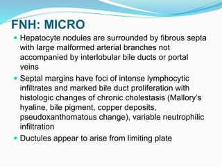 FNH: MICRO
 Hepatocyte nodules are surrounded by fibrous septa
with large malformed arterial branches not
accompanied by interlobular bile ducts or portal
veins
 Septal margins have foci of intense lymphocytic
infiltrates and marked bile duct proliferation with
histologic changes of chronic cholestasis (Mallory’s
hyaline, bile pigment, copper deposits,
pseudoxanthomatous change), variable neutrophilic
infiltration
 Ductules appear to arise from limiting plate
 