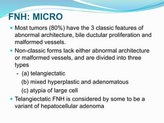 FNH: MICRO
 Most tumors (80%) have the 3 classic features of
abnormal architecture, bile ductular proliferation and
malformed vessels.
 Non-classic forms lack either abnormal architecture
or malformed vessels, and are divided into three
types
- (a) telangiectatic
(b) mixed hyperplastic and adenomatous
(c) atypia of large cell
 Telangiectatic FNH is considered by some to be a
variant of hepatocellular adenoma
 