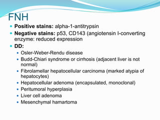 FNH
 Positive stains: alpha-1-antitrypsin
 Negative stains: p53, CD143 (angiotensin I-converting
enzyme: reduced expression
 DD:
 Osler-Weber-Rendu disease
 Budd-Chiari syndrome or cirrhosis (adjacent liver is not
normal)
 Fibrolamellar hepatocellular carcinoma (marked atypia of
hepatocytes)
 Hepatocellular adenoma (encapsulated, monoclonal)
 Peritumoral hyperplasia
 Liver cell adenoma
 Mesenchymal hamartoma
 