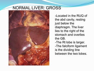 -Located in the RUQ of
the abd cavity, resting
just below the
diaphragm. The liver
lies to the right of the
stomach and overlies
the GB.
-The Rt lobe is larger.
-The falciform ligament
is the dividing line
between the two lobes.
NORMAL LIVER: GROSS
 