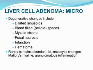 LIVER CELL ADENOMA: MICRO
 Degenerative changes include:
 Dilated sinusoids
 Blood filled (pelioid) spaces
 Myxoid stroma
 Focal necrosis
 Infarction
 Hematoma
 Rarely contains abundant fat, oncocytic changes,
Mallory’s hyaline, granulomatous inflammation
 