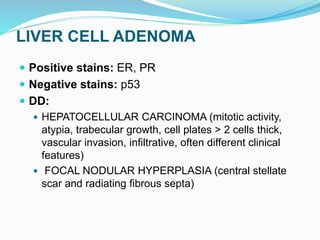 LIVER CELL ADENOMA
 Positive stains: ER, PR
 Negative stains: p53
 DD:
 HEPATOCELLULAR CARCINOMA (mitotic activity,
atypia, trabecular growth, cell plates > 2 cells thick,
vascular invasion, infiltrative, often different clinical
features)
 FOCAL NODULAR HYPERPLASIA (central stellate
scar and radiating fibrous septa)
 