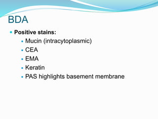 BDA
 Positive stains:
 Mucin (intracytoplasmic)
 CEA
 EMA
 Keratin
 PAS highlights basement membrane
 