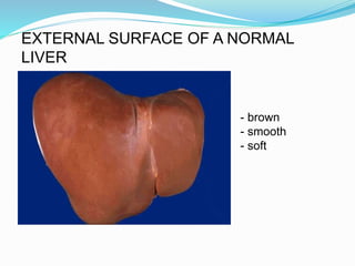 - brown
- smooth
- soft
EXTERNAL SURFACE OF A NORMAL
LIVER
 
