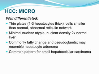 HCC: MICRO
Well differentiated:
 Thin plates (1-3 hepatocytes thick), cells smaller
than normal, abnormal reticulin network
 Minimal nuclear atypia, nuclear density 2x normal
liver
 Commonly fatty change and pseudoglands; may
resemble hepatocyte adenoma
 Common pattern for small hepatocellular carcinoma
 