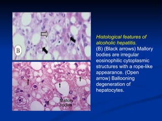 Liver (2) | PPT
