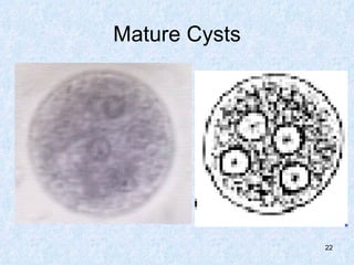Mature Cysts 