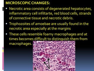 MICROSCOPIC CHANGES:
 Necrotic area consists of degenerated hepatocytes,
inflammatory cell infiltarte, red blood cells, strands
of connective tissue and necrotic debris.
 Trophozoites of amoebae are usually found in the
necrotic area especially at the margins
 These cells resemble foamy macrophages and at
times becomes difficult to distinguish them from
macrophages.
 