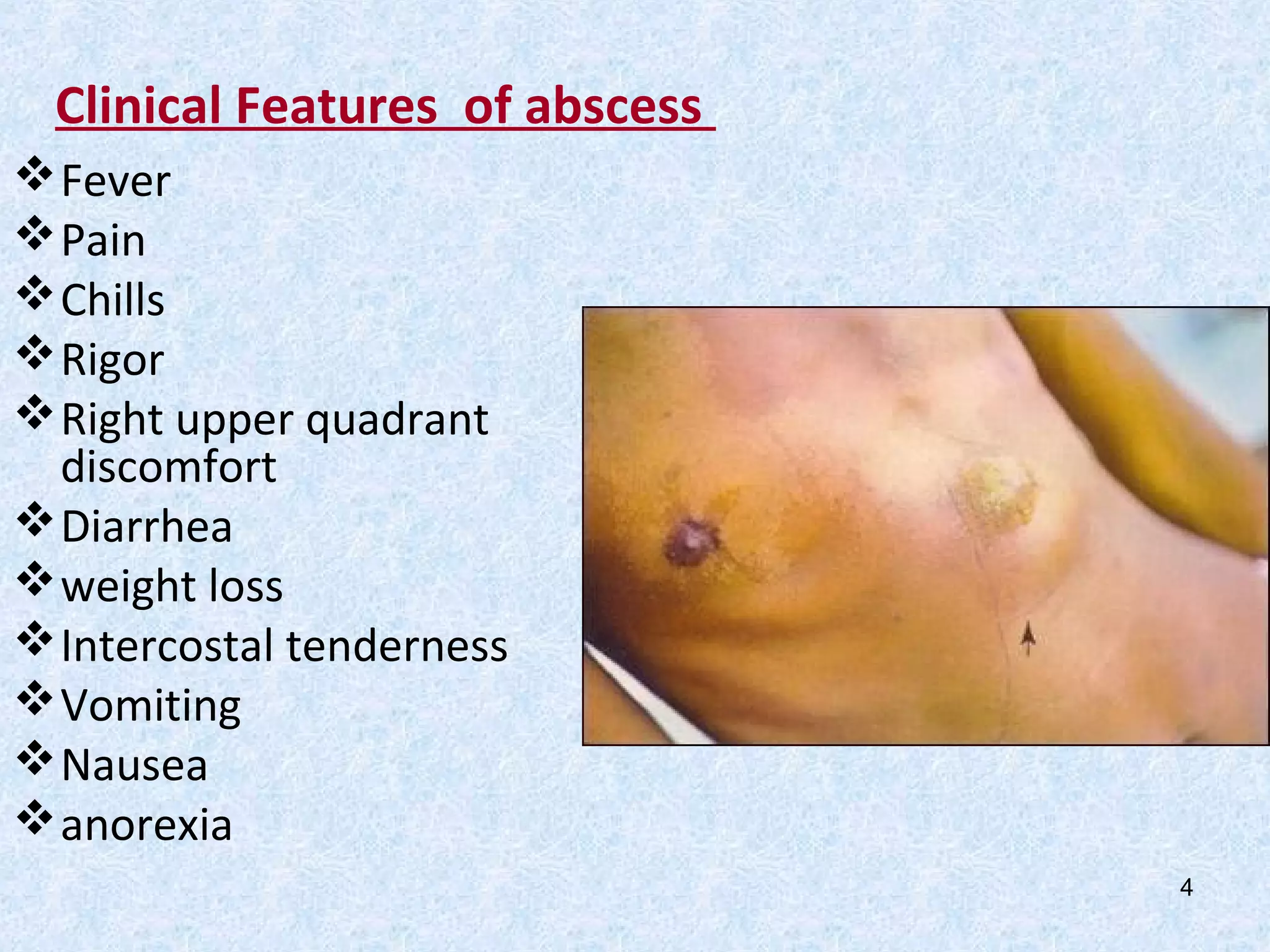 Liver abscess (AHN) | PPT
