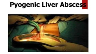 Pyogenic Liver Abscess
 