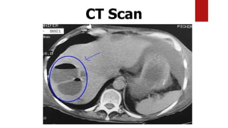 CT Scan
 