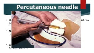 Percutaneous needle
aspiration
• Under CT or USG guidance, needle aspiration of cavity material can
be performed.
• Needle aspiration enables
– rapid recovery of material for microbiologic and pathologic
evaluation.
• Large percentage requires second or third aspirations to
achieve success
 