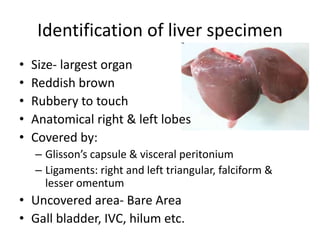Identification of liver specimen
• Size- largest organ
• Reddish brown
• Rubbery to touch
• Anatomical right & left lobes
• Covered by:
– Glisson’s capsule & visceral peritonium
– Ligaments: right and left triangular, falciform &
lesser omentum
• Uncovered area- Bare Area
• Gall bladder, IVC, hilum etc.
 