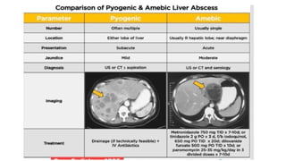 Liver Abscesses Algorithm Comprehensive Overview of Liver Abscess: Causes, Diagnosis, and ...