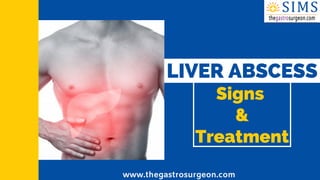 Signs
&
Treatment
LIVER ABSCESS
www.thegastrosurgeon.com
 