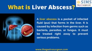 What is Liver Abscess?
A liver abscess is a pocket of infected
fluid (pus) that forms in the liver. It is
caused by infect...