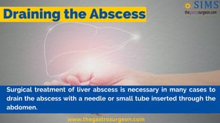 Draining the Abscess
Surgical treatment of liver abscess is necessary in many cases to
drain the abscess with a needle or ...