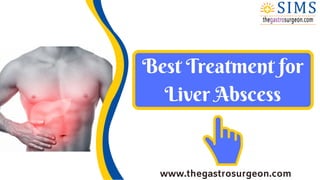 Best Treatment for
Liver Abscess
www.thegastrosurgeon.com
 