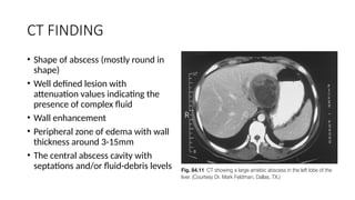 liver abscess with management and classification | PPTX