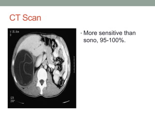 CT Scan
• More sensitive than
sono, 95-100%.
 