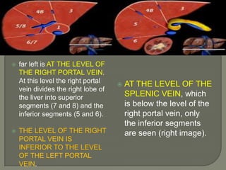 far left is at the level of the right portal vein. At this level the right portal vein divides the right lobe of the liver into superior segments (7 and 8) and the inferior segments (5 and 6).The level of the right portal vein is inferior to the level of the left portal vein.At the level of the splenic vein, which is below the level of the right portal vein, only the inferior segments are seen (right image).