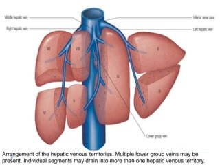 Arrangement of the hepatic venous territories. Multiple lower group veins may be
present. Individual segments may drain into more than one hepatic venous territory.
 