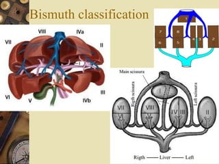 Bismuth classification
 