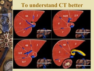 To understand CT better
 