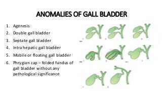 Folded Over Gallbladder Liver and extra hepatic biliary apparatus.pptx