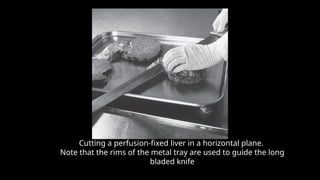 Cutting a perfusion-fixed liver in a horizontal plane.
Note that the rims of the metal tray are used to guide the long
bladed knife
 