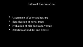 Internal Examination
• Assessment of color and texture
• Identification of portal tracts
• Evaluation of bile ducts and vessels
• Detection of nodules and fibrosis
 