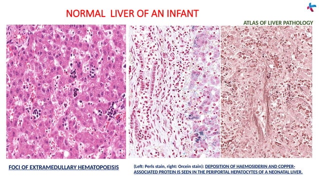 Fundamentals of LIVER pathology [Autosaved].pptx