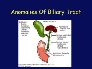 Anomalies Of Biliary Tract
 