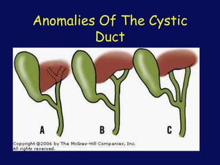 Anomalies Of The Cystic
Duct
 