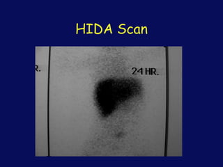 HIDA Scan
 