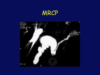 MRCP
 