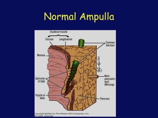 Normal Ampulla
 