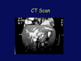 CT Scan
 