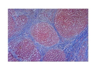 Comprehensive Overview of Liver Anatomy, Function, and Pathology | PPTX