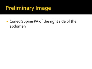  Coned Supine PA of the right side of the
abdomen
 