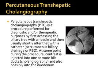  Percutaneous transhepatic
cholangiography (PTC) is a
procedure performed for
diagnostic and/or therapeutic
purposes by first accessing the
biliary tree with a needle and then
usually shortly after that with a
catheter (percutaneous biliary
drainage or PBD). At some point
during the procedure, contrast is
injected into one or more bile
ducts (cholangiography) and also
possibly into the duodenum
 