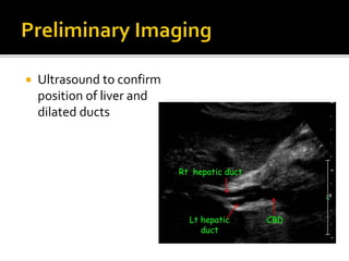  Ultrasound to confirm
position of liver and
dilated ducts
 