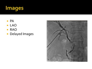  PA
 LAO
 RAO
 Delayed Images
 