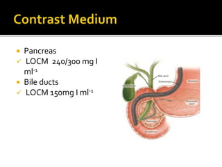  Pancreas
 LOCM 240/300 mg I
ml-1
 Bile ducts
 LOCM 150mg I ml-1
 