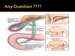 Liver, biliary tract &amp; pancreas