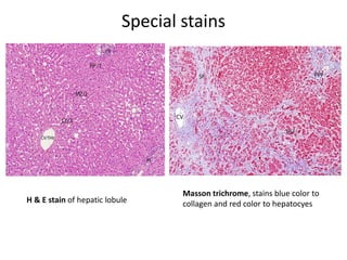 Special stains
Masson trichrome, stains blue color to
collagen and red color to hepatocyesH & E stain of hepatic lobule
 