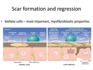 Scar formation and regression
• Stellate cells – most important, myofibroblastic properties
 