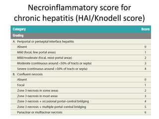 Necroinflammatory score for
chronic hepatitis (HAI/Knodell score)
 
