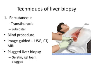 Techniques of liver biopsy
1. Percutaneous
- Transthoracic
– Subcostal
• Blind procedure
• Image guided – USG, CT,
MRI
• Plugged liver biopsy
– Gelatin, gel foam
plugged
 